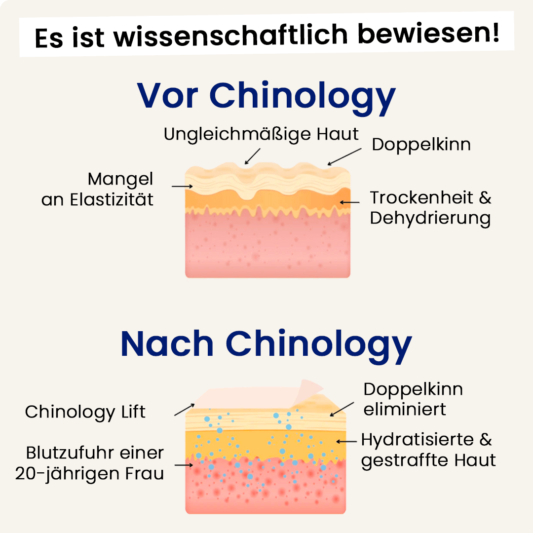 Der Chinology™ Lift (v2)