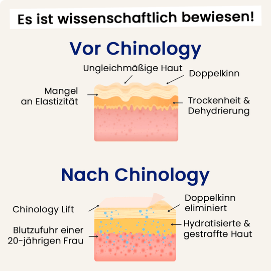 Der Chinology™ Lift (v2)